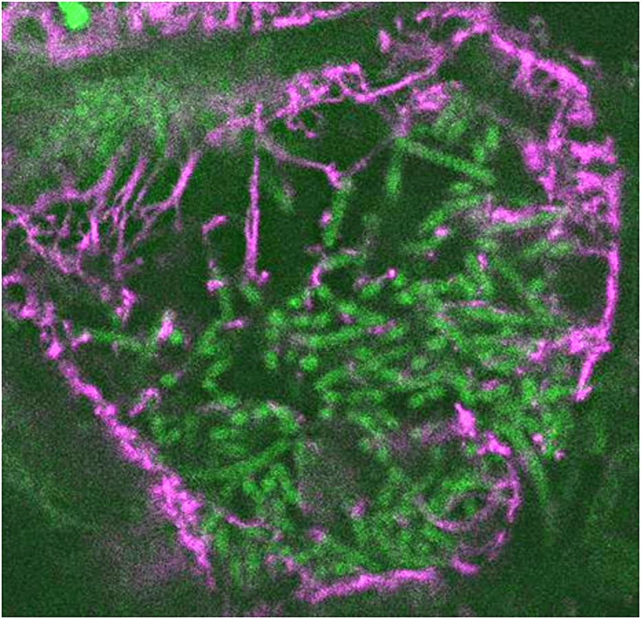 Конфокальная микроскопия. Клетка люцерны с симбиотическими бактериями и микротрубочками (иммунометка тубулина, сиреневый цвет).