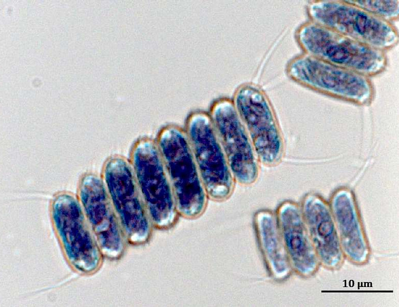 Ученые ИФР РАН впервые показали, что штаммы зеленых микроводорослей Neochlorella semenenkoi и Desmodesmus armatus могут использоваться в производстве современных пищевых продуктов, кормов и экологических материалов